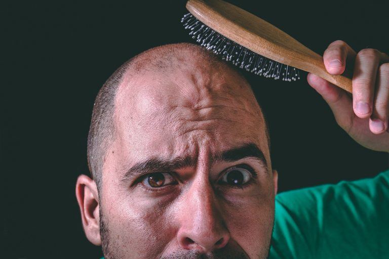 What Is the Time It Takes to Go Bald? 