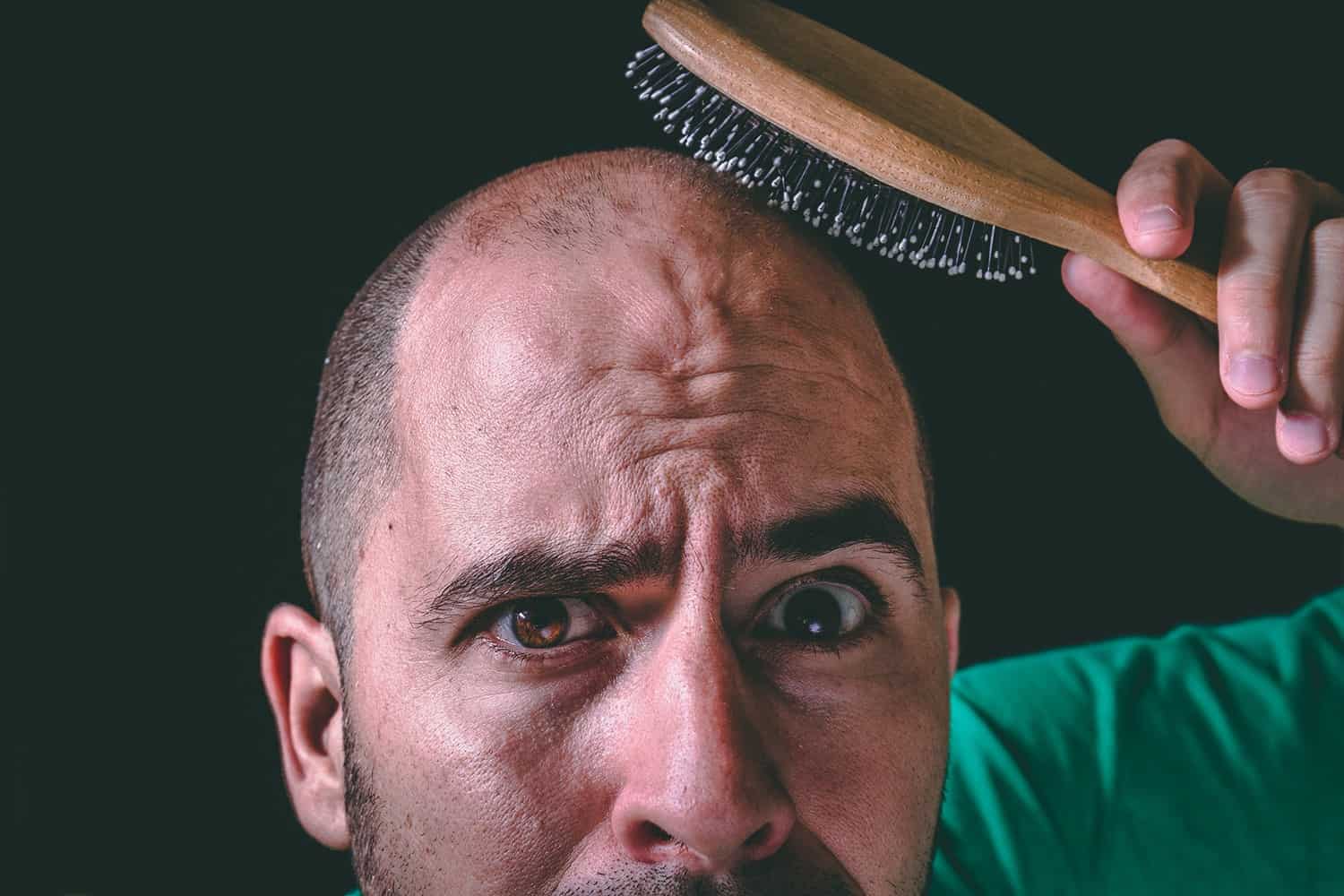 How Long Does it Take to Go Bald? The Answer May Surprise You