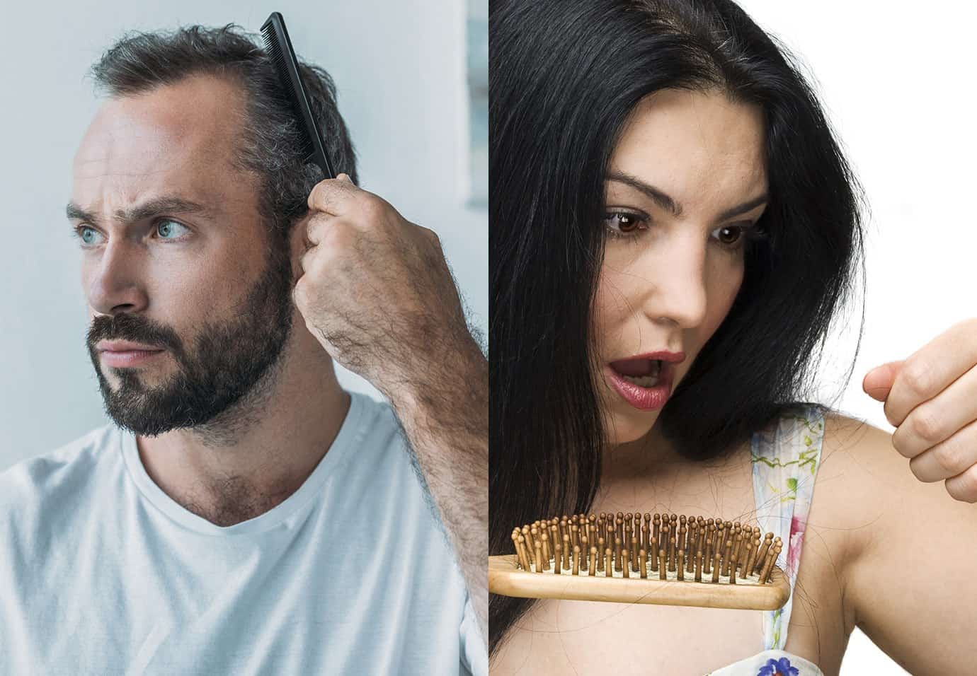 How to Stop Hair Loss in Men & Women With These 15 Methods
