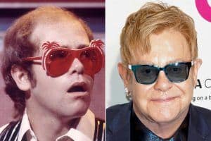 Elton John hair transplant