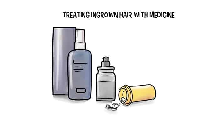 Treating Ingrown Hair With Medicine