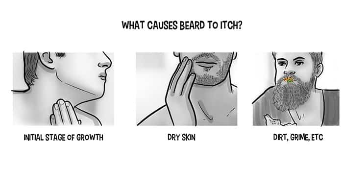 Beard Oil Helps Get Rid of the Dreaded Beard Itch