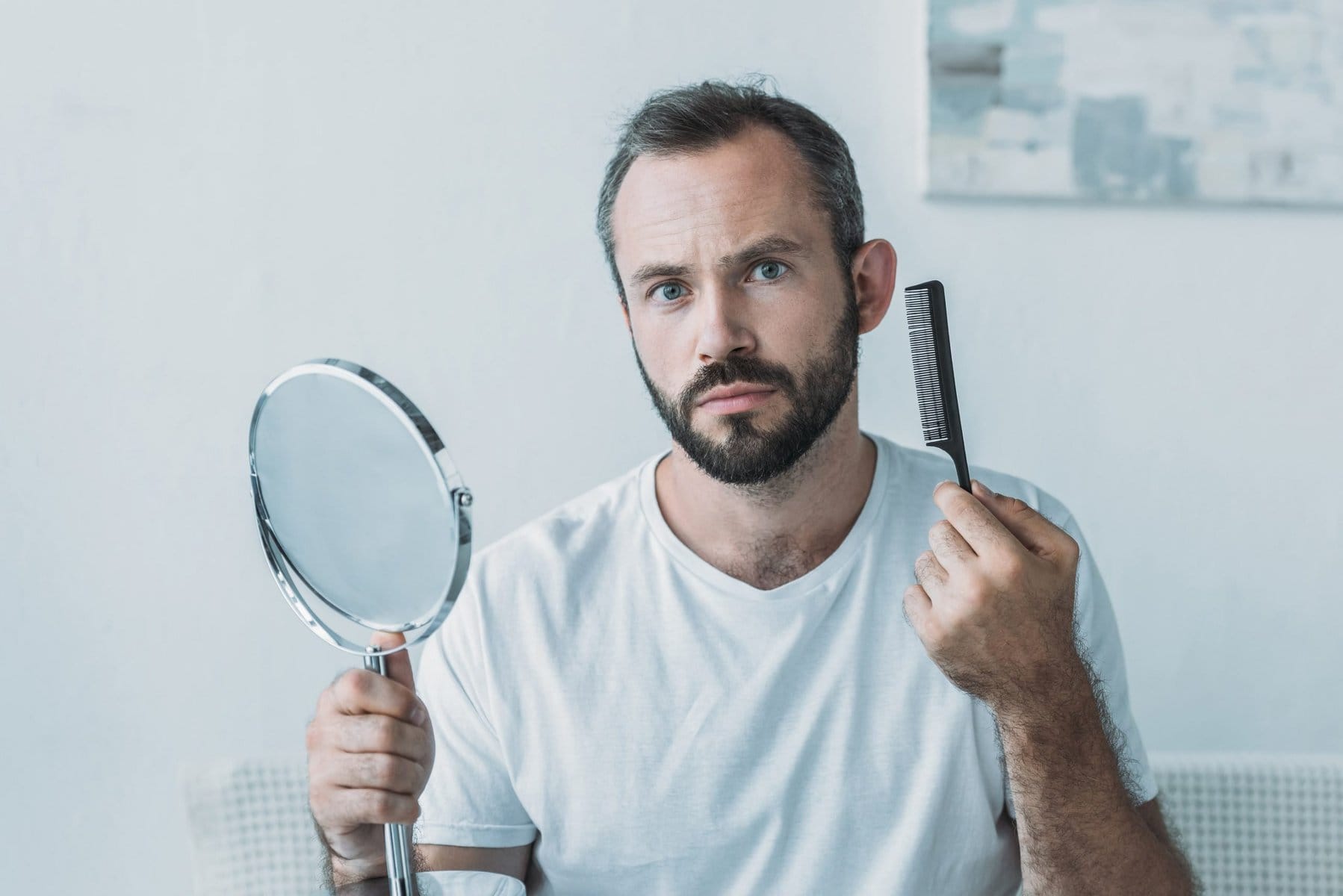 Top 5 Hair Loss Treatments for Men
